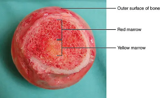 A femoral head with both red bone marrow and a central focus of yellow bone marrow visible (Wikipedia)